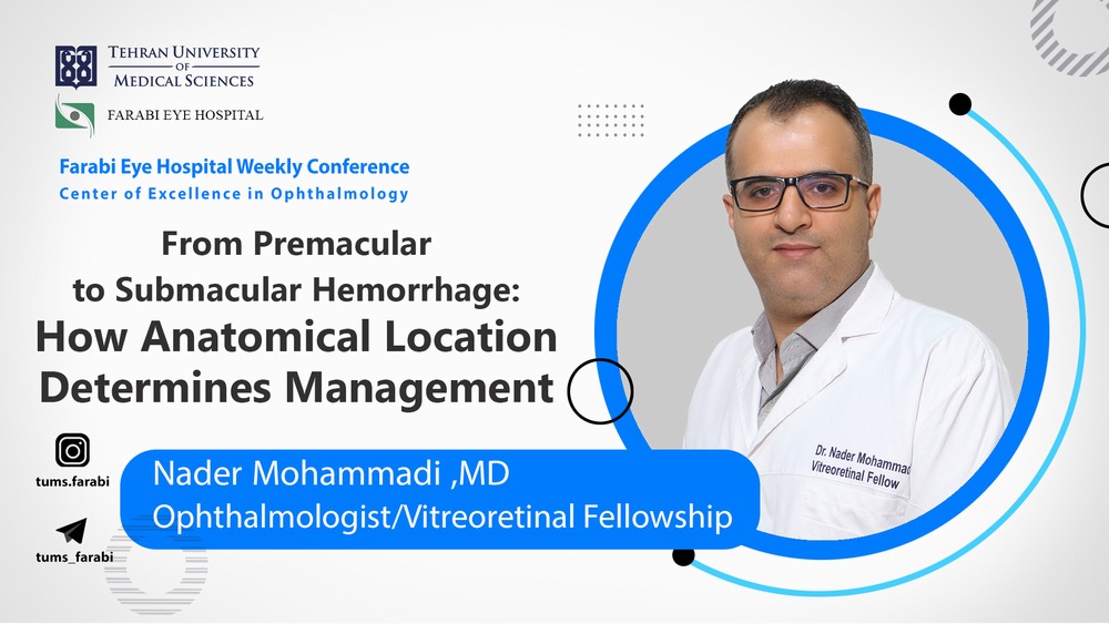 مدیریت خونریزی‌های ماکولا؛ از فضای پری‌ماکولار تا ساب‌ماکولار